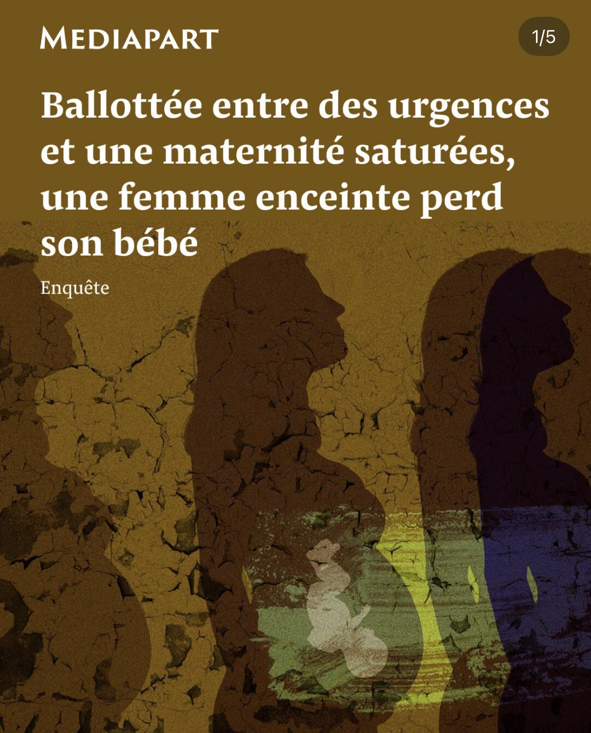 Médiapart, 09 juillet 2025 : « Ballottée entre des urgences et une maternité saturées, une femme enceinte perd son bébé »